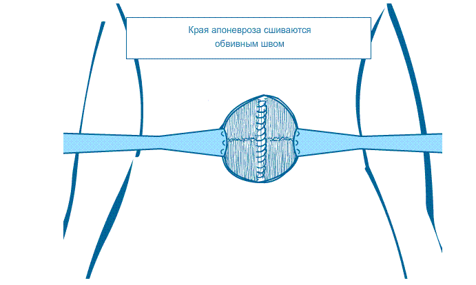 рижи