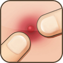 Pimple Popper 25.0 descargador