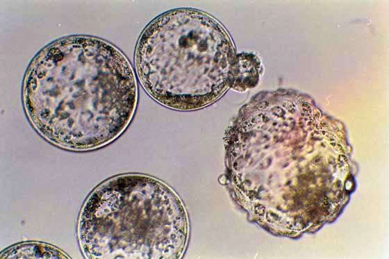 Expanded, hatching and hatched blastocysts produced by in vitro fertilization with frozen-thawed semen following in vitro maturation.