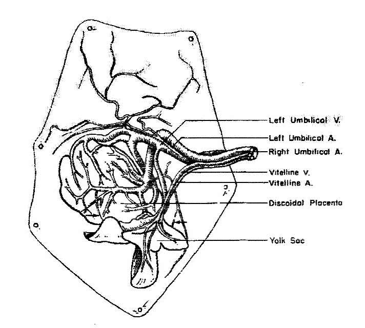 Insertion of umbilical cord and vascular distribution over the placental disk