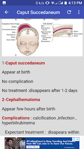 OSCE IN OBST  GYNAE