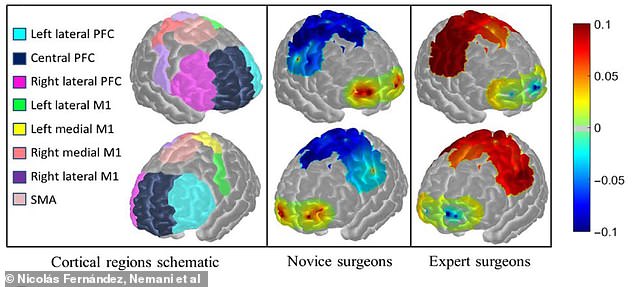 According to the researchers, novice surgeons experienced increased activity in different areas of the brain than seen in the skilled surgeons. In skilled surgeons, on the other hand, activity in the motor cortex spiked