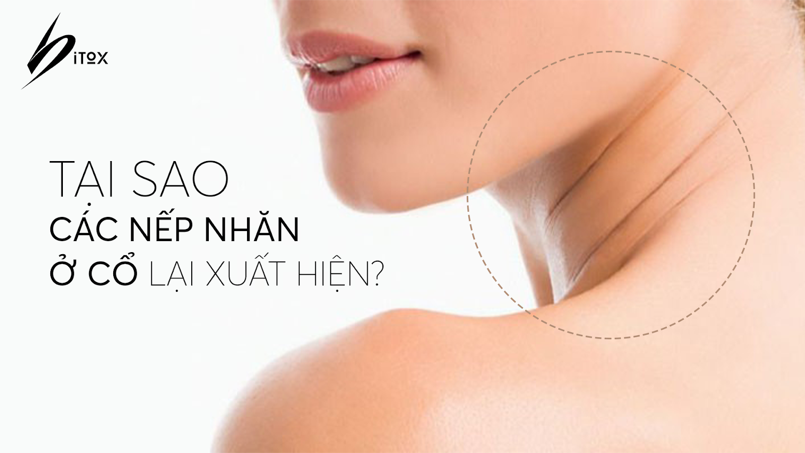 Nếp nhăn cổ: 6 kỹ thuật đã được chứng minh để thoát khỏi nếp nhăn ở cổ