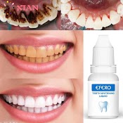 Tinh Chất Làm Trắng Răng Khói Chăm Sóc Sức Khỏe Halitosis