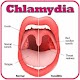 Download Chlamydia In Throat For PC Windows and Mac 1.0