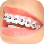 Cover Image of Download Braces App That Look Real 1.3 APK