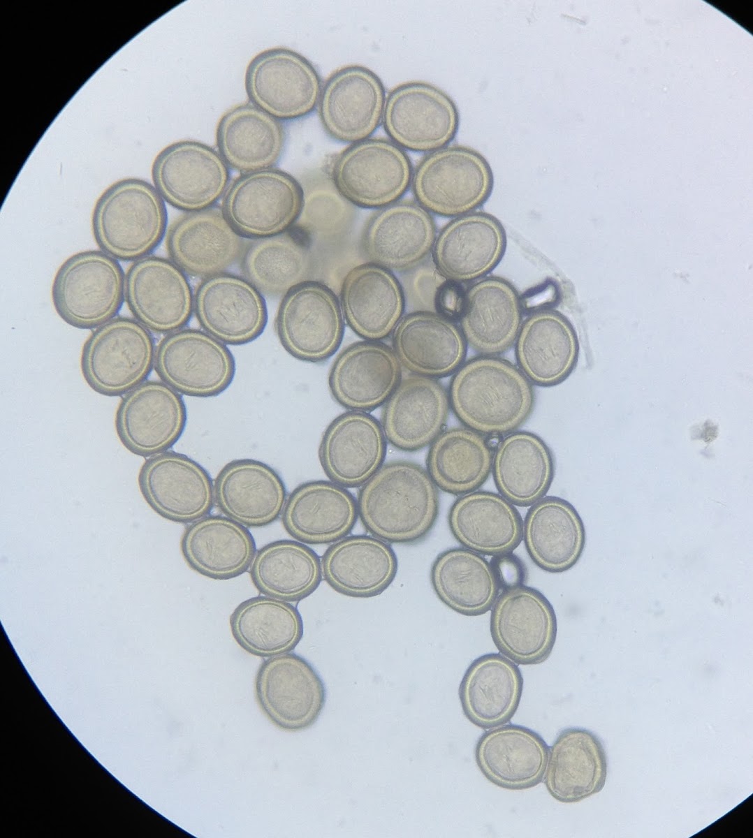 Tapeworm Eggs