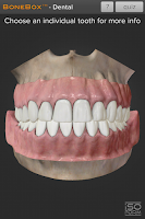 BoneBox™ - Dental Lite Screenshot