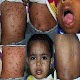 Dermatology Atlas & Skin Infections Download on Windows