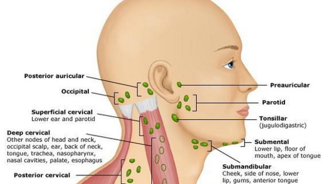 Nổi hạch ở quai hàm phải là bệnh gì? Có nguy hiểm không?