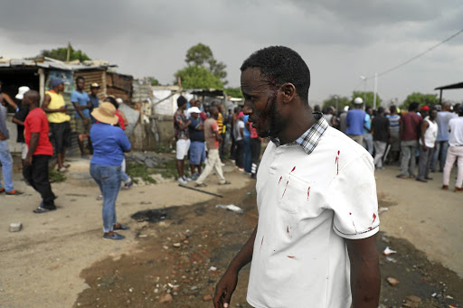 A Somali national was hit with a rock as locals tried to loot a foreign-owned shop in Diepsloot yesterday.