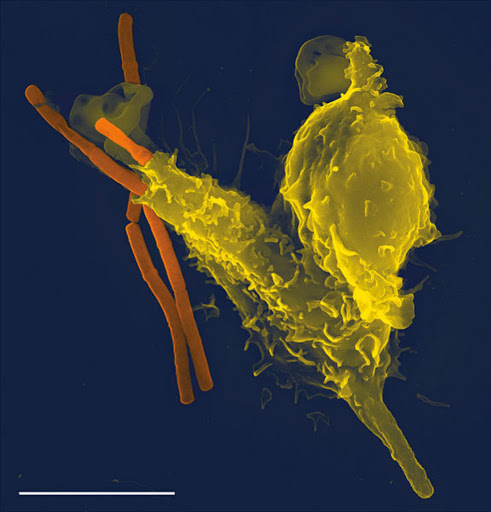 A scanning electron microscope image of a single neutrophil (yellow), engulfing anthrax bacteria (orange). This is part of the immune system. File photo.