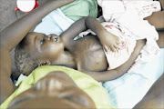 BAD STATE: Malnutrition is  under-appreciated because poor nutrition is  mistaken for a lack of food  photo: Muntu Vilakazi