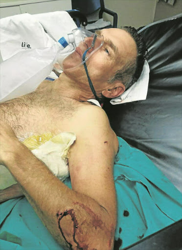 Kent Venish who was stabbed and mugged while jogging in Gonubie. Picture: SUPPLIED