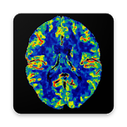 CT PERFUSION IMAGING  Icon