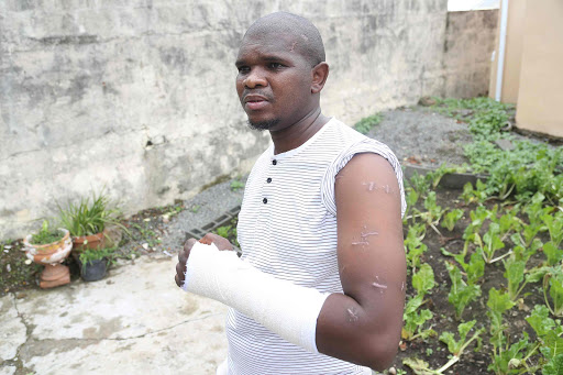 LUCKY TO BE ALIVE: Thandinkosi Maseti of Cofimvaba shows the Daily Dispatch wounds he sustained when he was shot and stabbed during a hijacking on New Year’s Eve Picture: MARK ANDREWS