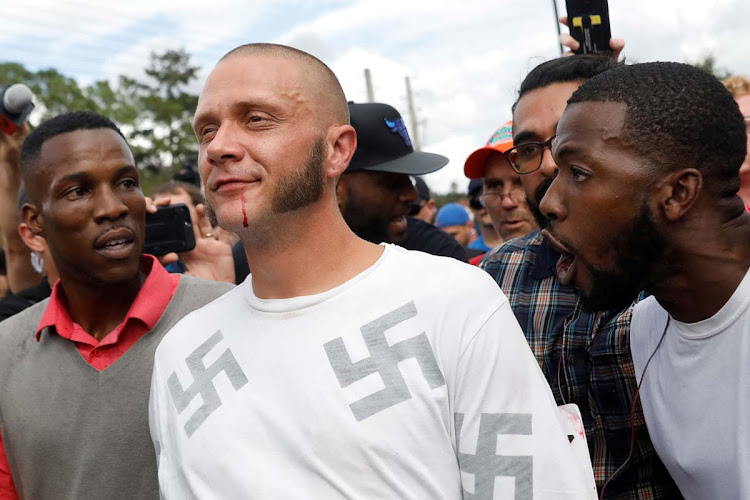 A man walks with a bloody lip as demonstrators yell at him outside the location where Richard Spencer, an avowed white nationalist and spokesperson for the so-called alt-right movement, delivered a speech on the campus of the University of Florida in Gainesville, Florida, US, October 19, 2017.