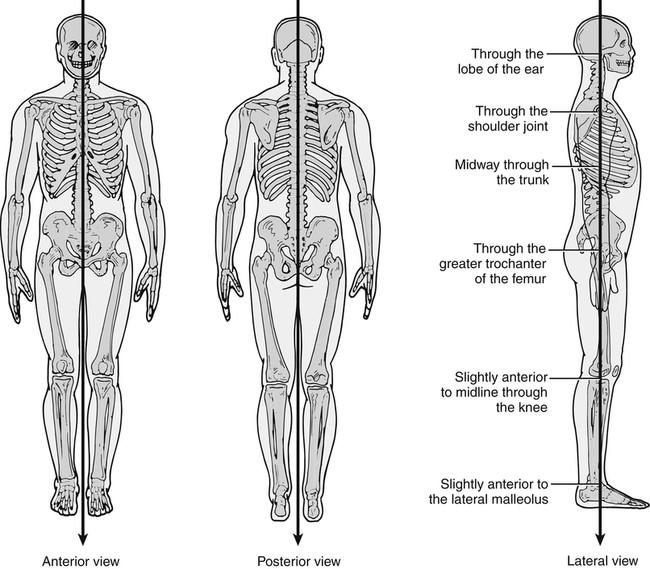 Standing-body alignment A) Lateral View-Good posture. B) Lateral