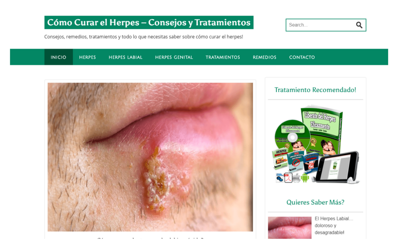 Cómo Curar El Herpes Preview image 0