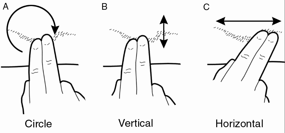 terapia de manos para el manejo de cicatrices