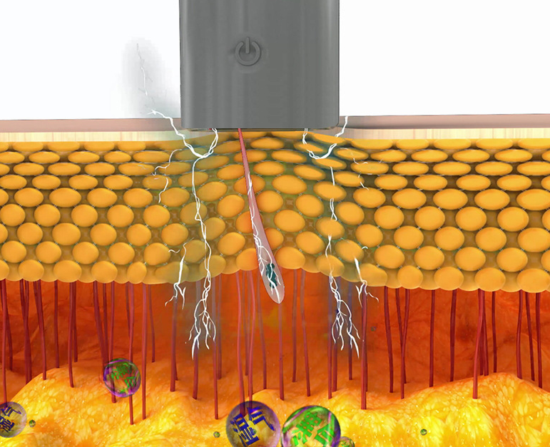 Aparelho de Cupping Terapia Elétrico de Silicone Massagem Corporal EMS Massager Sucção Alívio da Dor Relaxamento Total