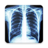 CHEST RADIOLOGY1.0