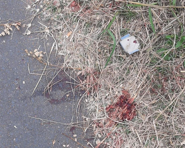 Blood on the road after a KwaZulu-Natal woman survived a pit bull attack on Tuesday.