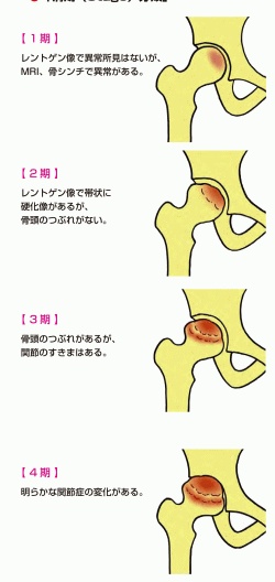 自滅の刃 さんが投稿した変態仮面・足が痛い・下らない話に関するカスタム事例の投稿画像4枚目