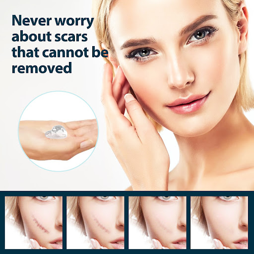 Title 6, Fade Scar Gel for skin hyperplasia, burning car...