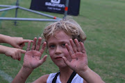 William Basson, 7, shows the rips on his hands following his 527m monkey bar challenge 