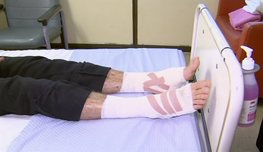 Tinejdžer u bolnici posle napada morskih vaški
