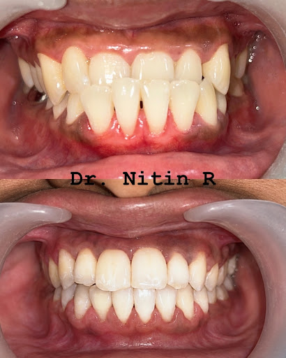BrightAlign Dental Clinic — business photo 10