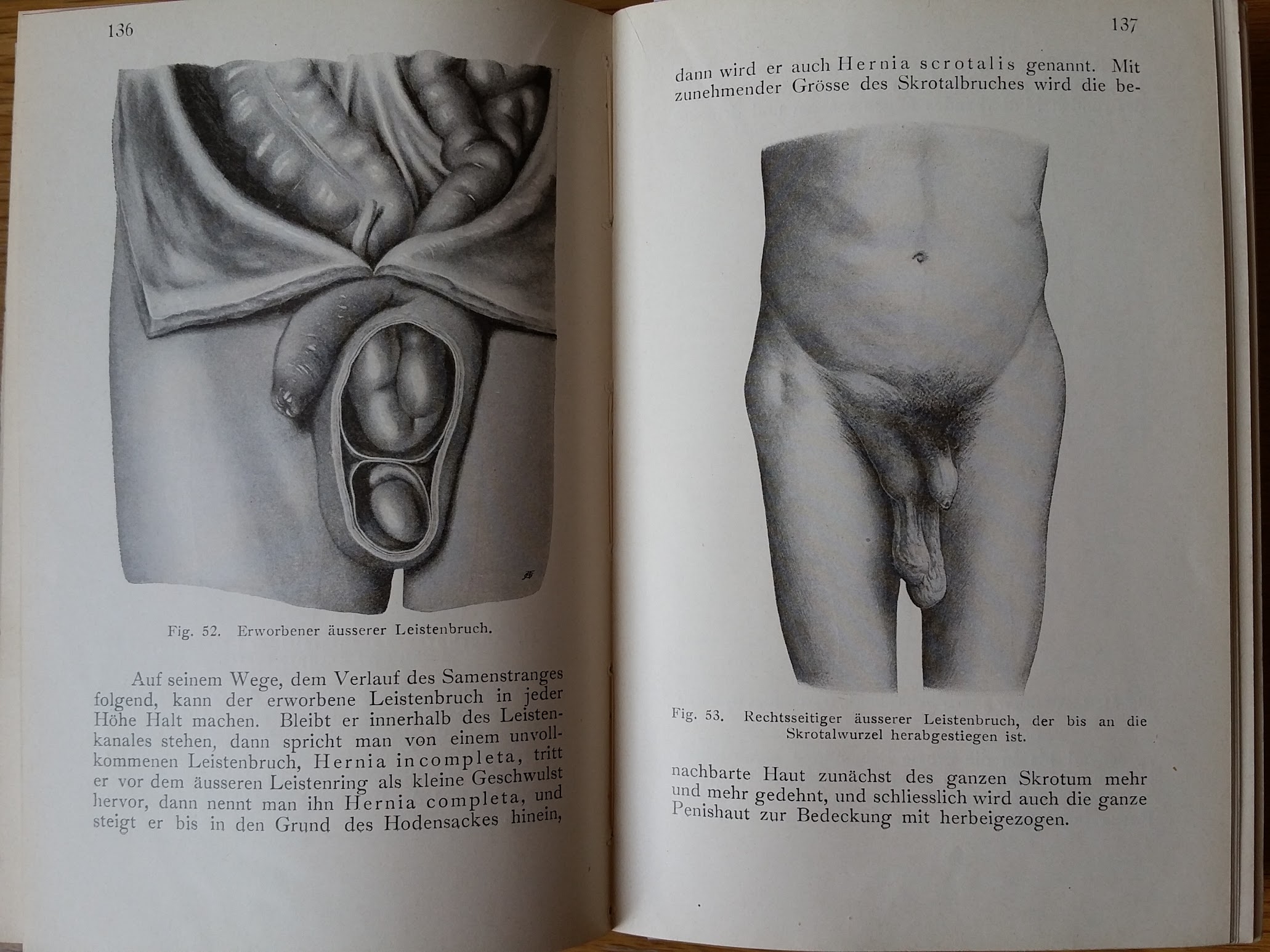 Dr. Georg Sultan - Grundriss und Atlas der Speziellen Chirurgie - 1910