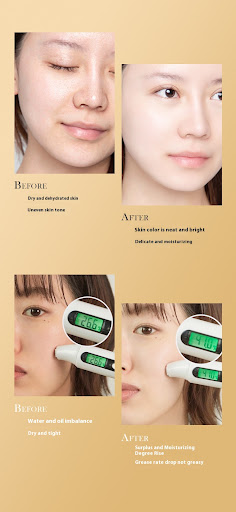 Title 2, Fade Black Acne Marks Cream Brightening and Rem...