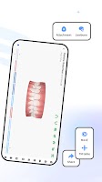 Angel Aligner DoctorApp-iOrtho Screenshot 3 of 6