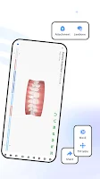 Angel Aligner DoctorApp-iOrtho Screenshot 3 of 6