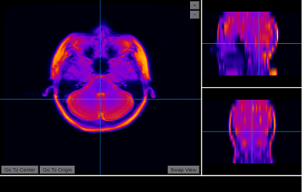 MRI Scalar small promo image