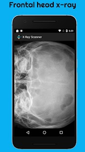 X-Ray  Scanner Prank-Camera Body Scanner Simulator Screenshot