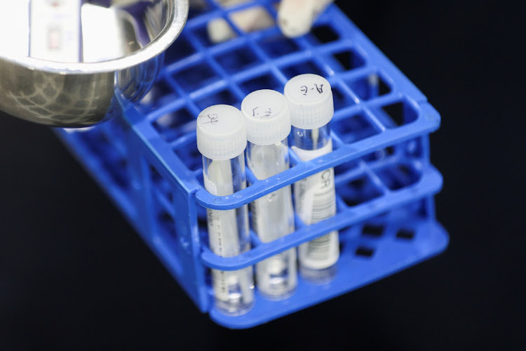 The National Institute for Communicable Diseases says PCR tests detect the Omicron variant. File Photo