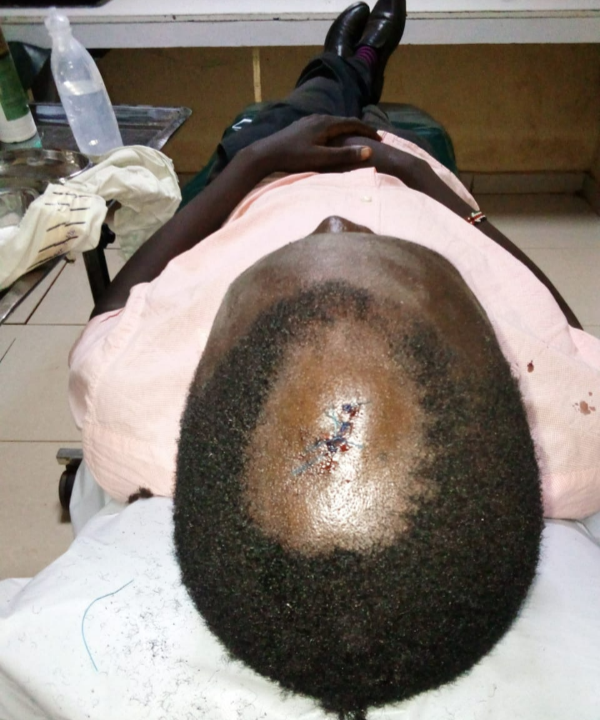 The wound that Odanga was left with after an assault incident.