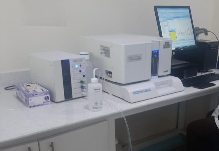 The HLA tissue typing centre at KNH that will enable compatibility tests for kidney transplants.