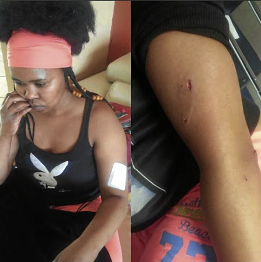 Zahara shows her injury on social media.