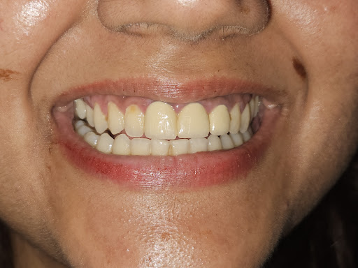 Dentist , Dr Raman Prajapat , Dental surgeon. Dental clinic, scaling, best rct, tooth extraction, Berhampore, — business photo 5