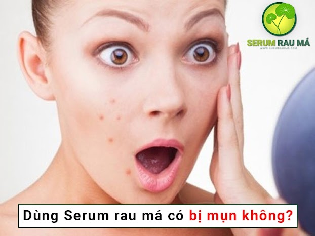 Trả lời Câu Hỏi : Sử dụng serum rau má có bị lên mụn không?