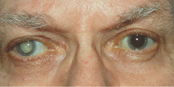 Ojos de una persona
Descripción generada automáticamente