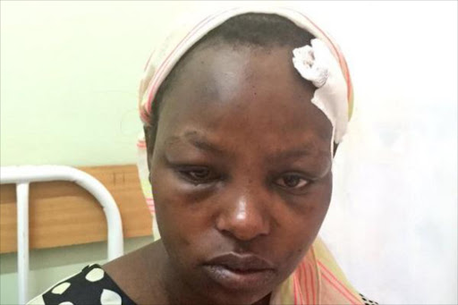 Justa Kawira at Nairobi's Lang'ata hospital where she was admitted after allegedly being beaten by her husband. Photo/COURTESY