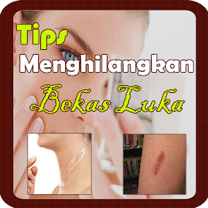 Download Tips Menghilangkan Bekas Luka For PC Windows and Mac