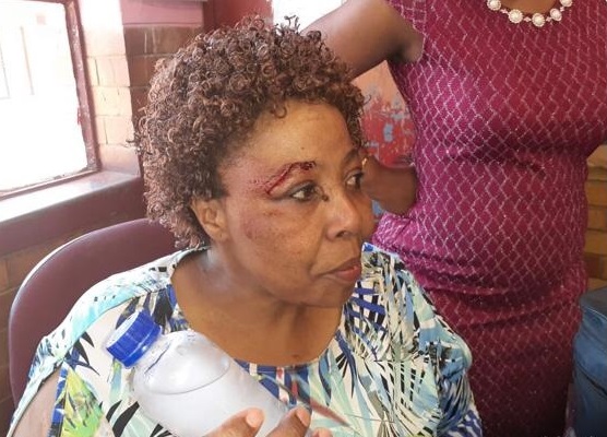 A teacher at Sakhile Primary School in Heidelberg suffered a face wound when a pupil threw a pencil case at her.