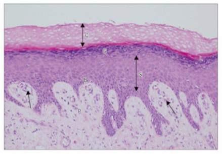 Histology of Skin