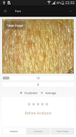 Artistry Skin Analyzer Screenshot